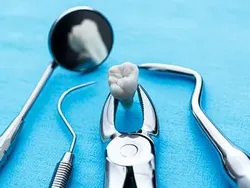 Удаление одного зуба простое