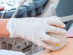 УЗИ - исследование