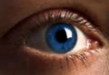 В Ярославле разработали уникальную мобильную установку для коррекции зрения