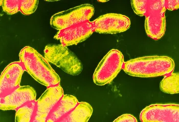 В Ярославле школьники и детсадовцы отправлены на карантин по скарлатине и коклюшу