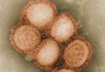 В Ярославле подтвердились случаи заболевания свиным гриппом