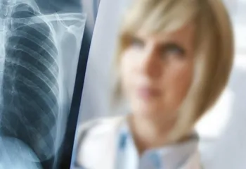 Рентгенография органов грудной клетки