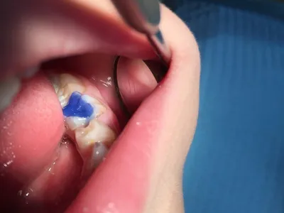 детская стоматология