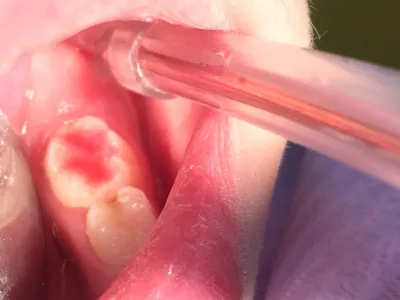 детская стоматология