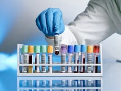 Все виды анализов