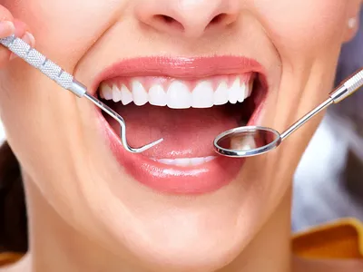 Лечение зубов