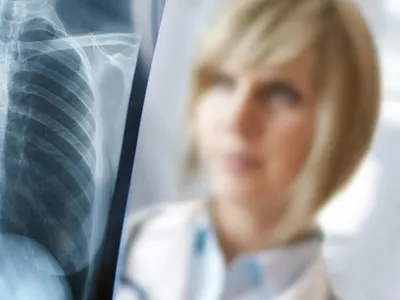 Флюорография