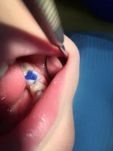 детская стоматология