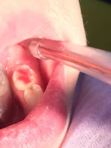 детская стоматология